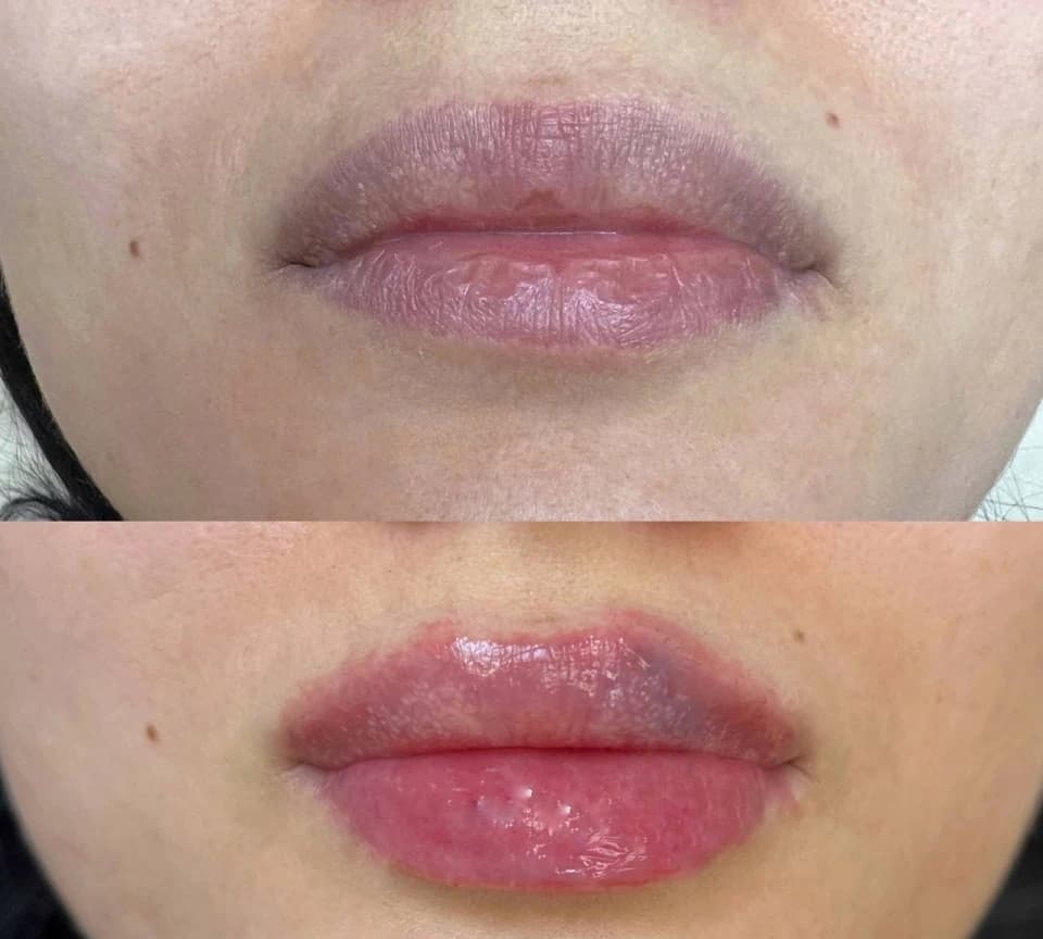 Салон красоты Клиника косметологии Pro Skin на улице Маяковского - 4