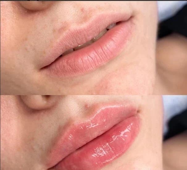 Салон красоты Студия косметологии Agent face - 3