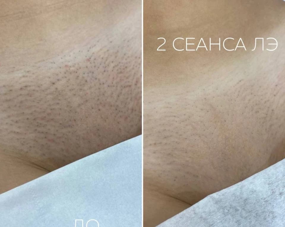 Салон красоты Студия красоты Леденец на улице Карла Маркса - 5