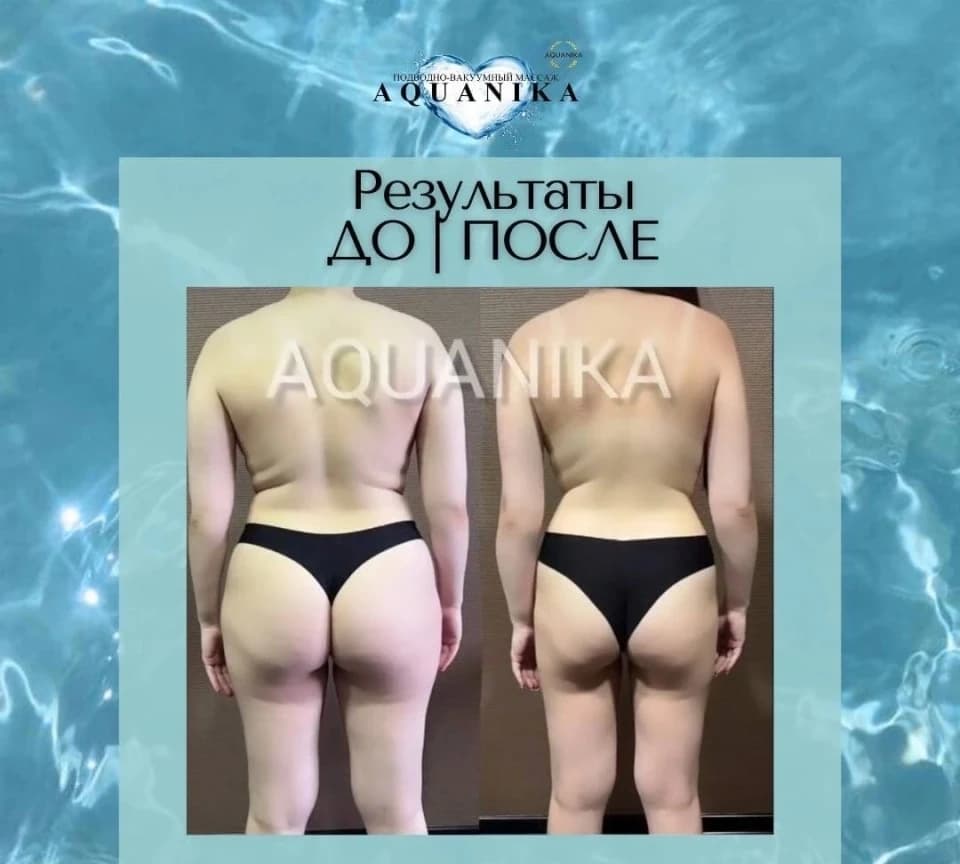 Салон красоты вакуумного-гидромассажа Акваника - 2