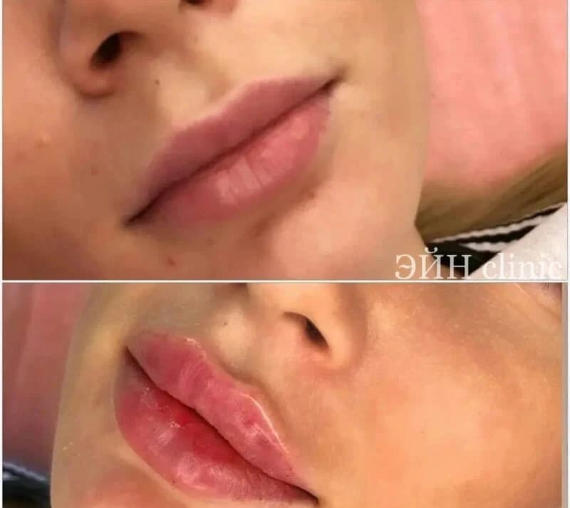 Салон красоты Клиника эстетической медицины Эйн clinic - 2
